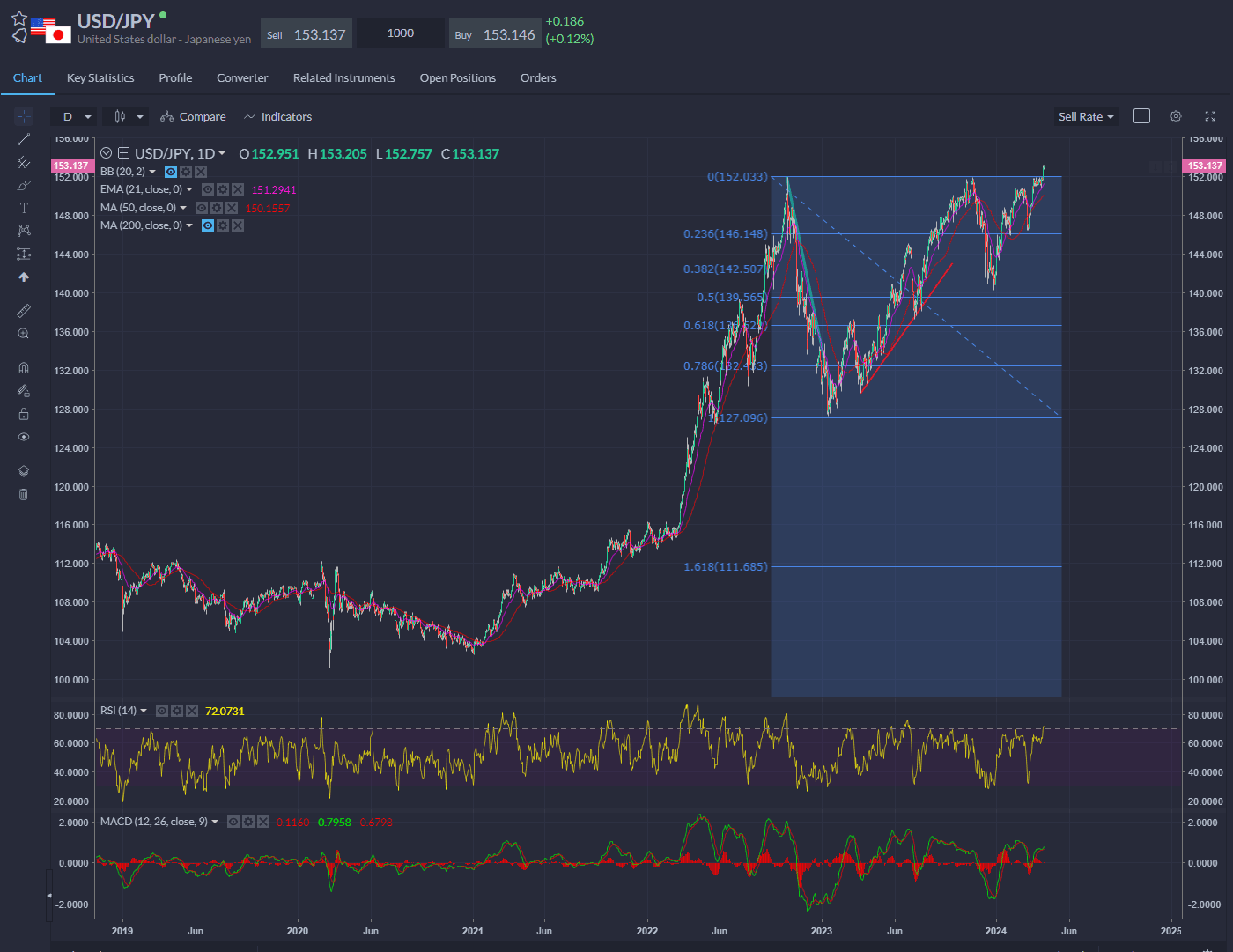 Japan is on currency intervention watch